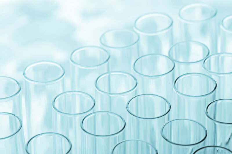Semen Detection Test Lab